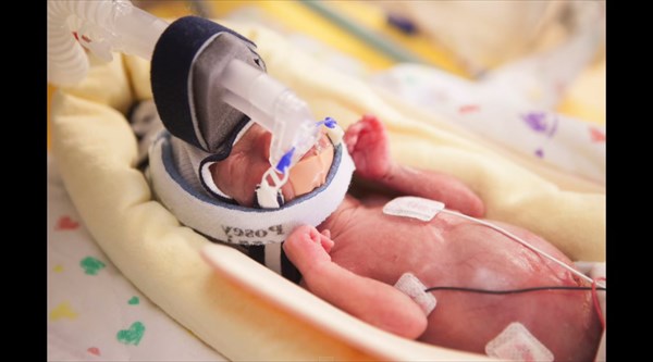 胸を打つ わずか500gで生まれた赤ちゃん 懸命に生き続けた彼に奇跡が起きる Buzzmag